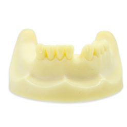 MODELO DE ESTUDIO IMPLANTOLOGIA INFERIOR M2028 MACHTIG